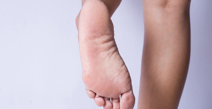 Is Vaseline Good For Dry Feet? | 3 